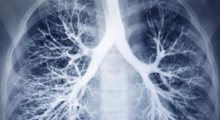 Bronchoscopy - Visualizing the Lungs for Accurate Diagnosis