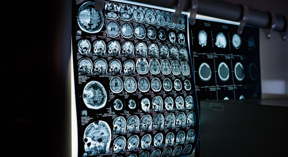 MRI – Imaging with Clarity and Comfort