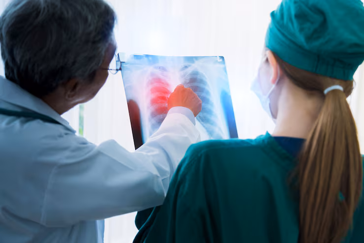 Advanced Lung Cancer Treatment in Bangalore - ARC Cancer Hospital
